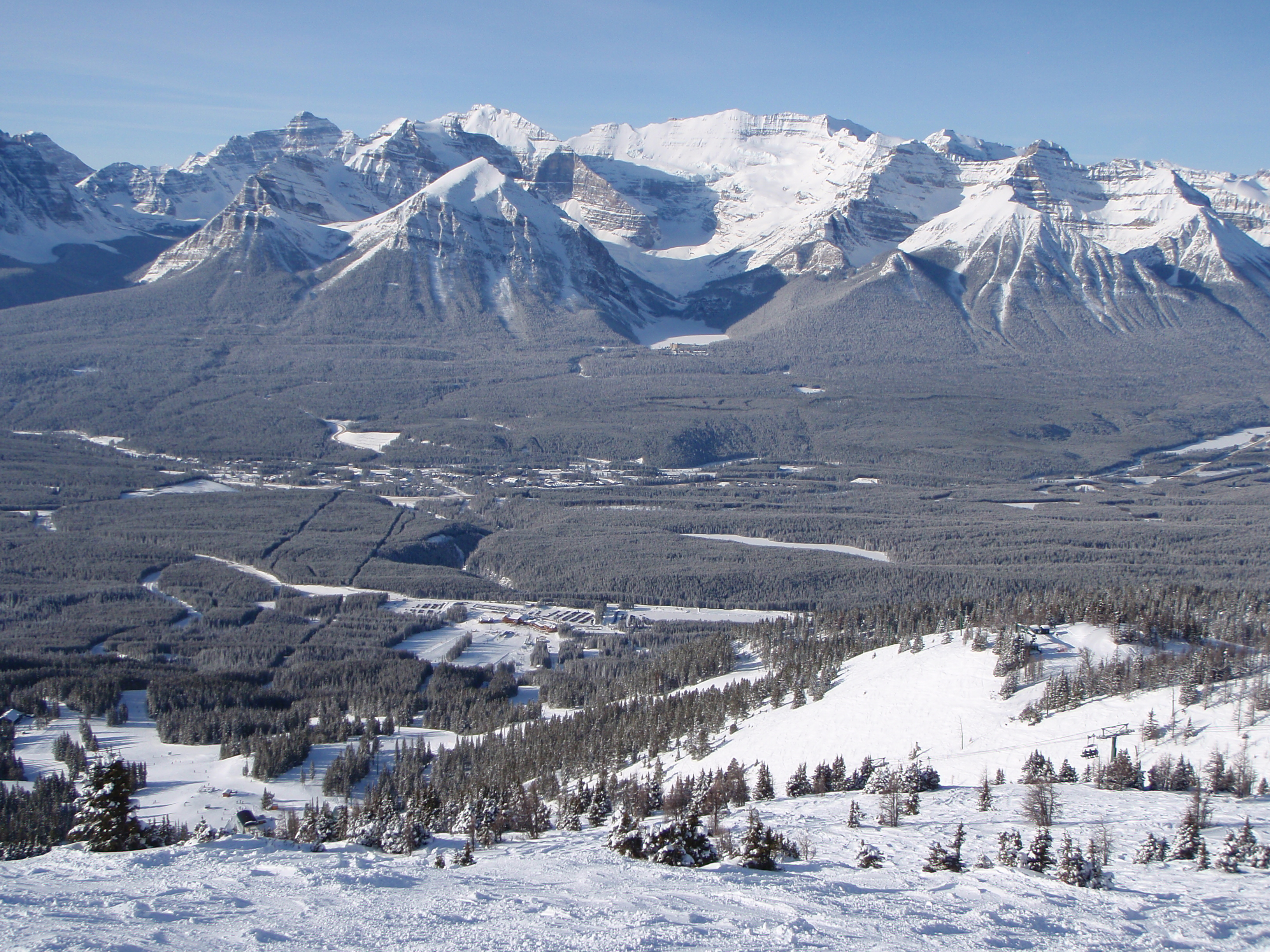 The Sun does shine in LL, Lake Louise
