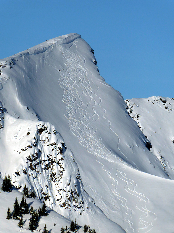 Wisdom tooth, Kicking Horse